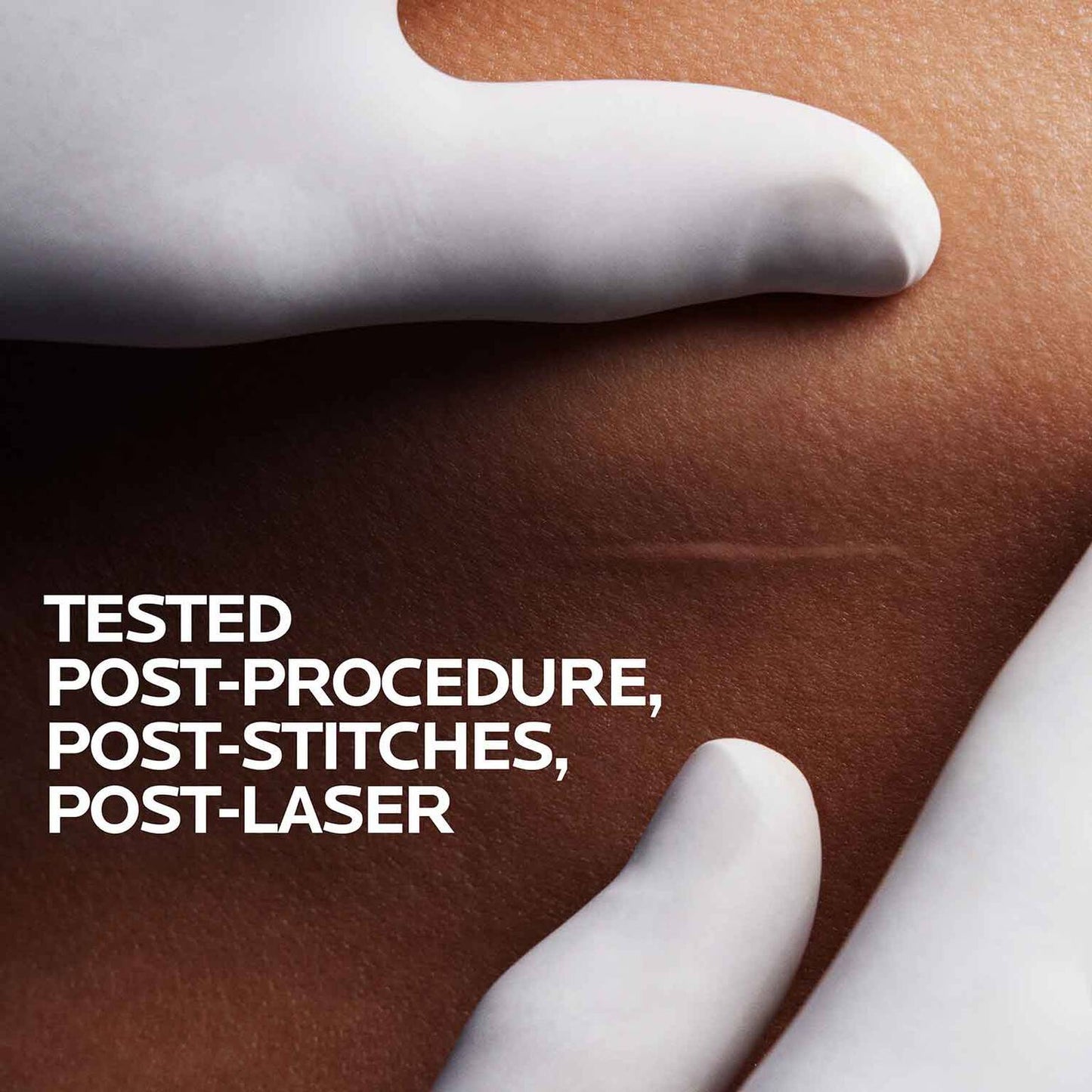 cicaplast-gel-b5-skin-protectant-u1 06-cicaplast-gel-model-1500x1500.jpg
