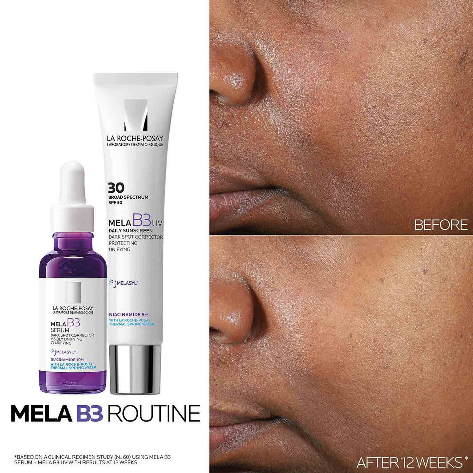 mela-b3-dark-spot-serum-and-mela-b3-uv-daily-moisturizer-with-spf-30-q3 3-Mela-B3-routine_1500X1500.jpg