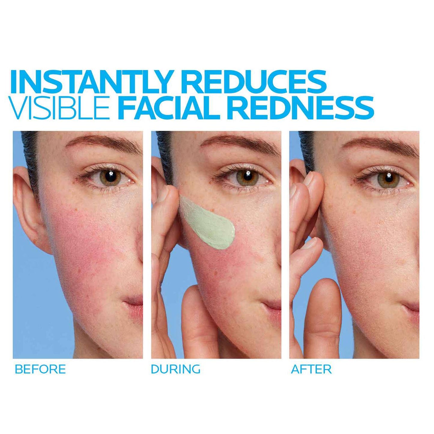 toleriane-rosaliac-ar-face-cream-for-visible-redness-a0 8_Toleriane_Rosaliac-AR-before-after.jpg