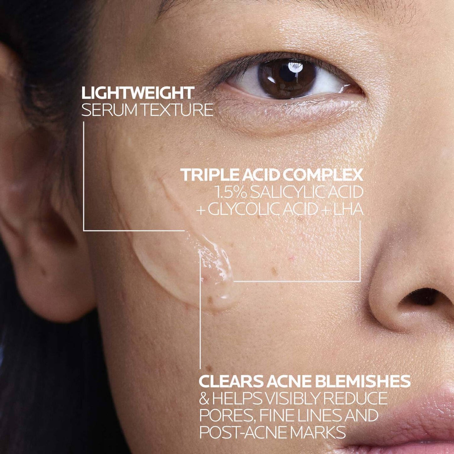 effaclar-salicylic-acid-acne-treatment-serum-o3 LaRochePosay-Product-Effaclar-Effaclar-Serum-30ml-3337875722827-Texture-REV.jpg