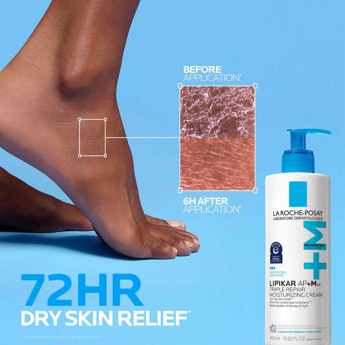 lipikar-ap-max-triple-repair-moisturizing-cream-r8 LaRochePosay-Product-Skincare-Lipikar-Balm-AP+MAX-400ml-3337875941150-ATF-PIM-BeforeAfter.jpg
