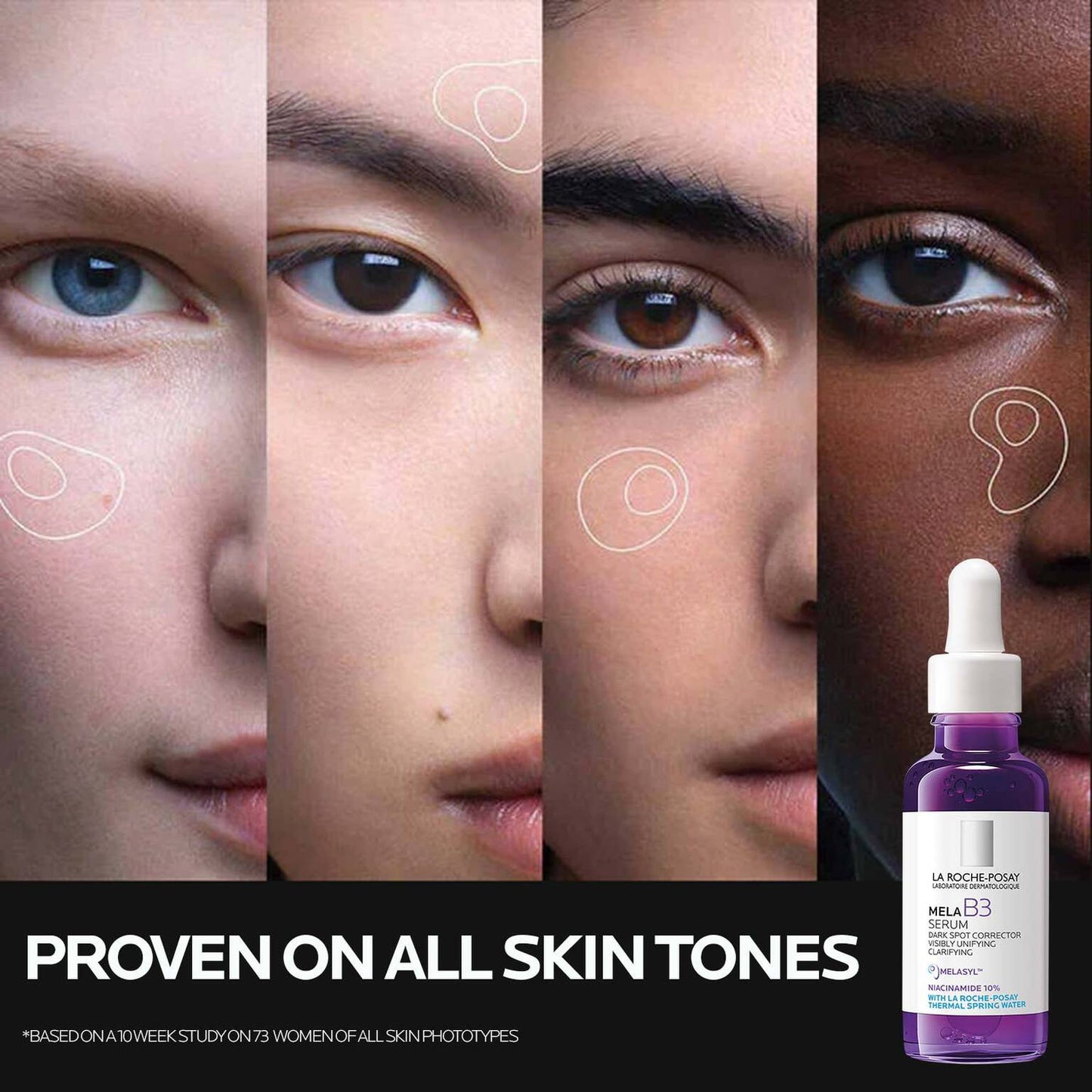 mela-b3-dark-spot-serum-with-melasyltm-niacinamide-s4 Mela-B3-SuitableFor-1500x1500.jpg