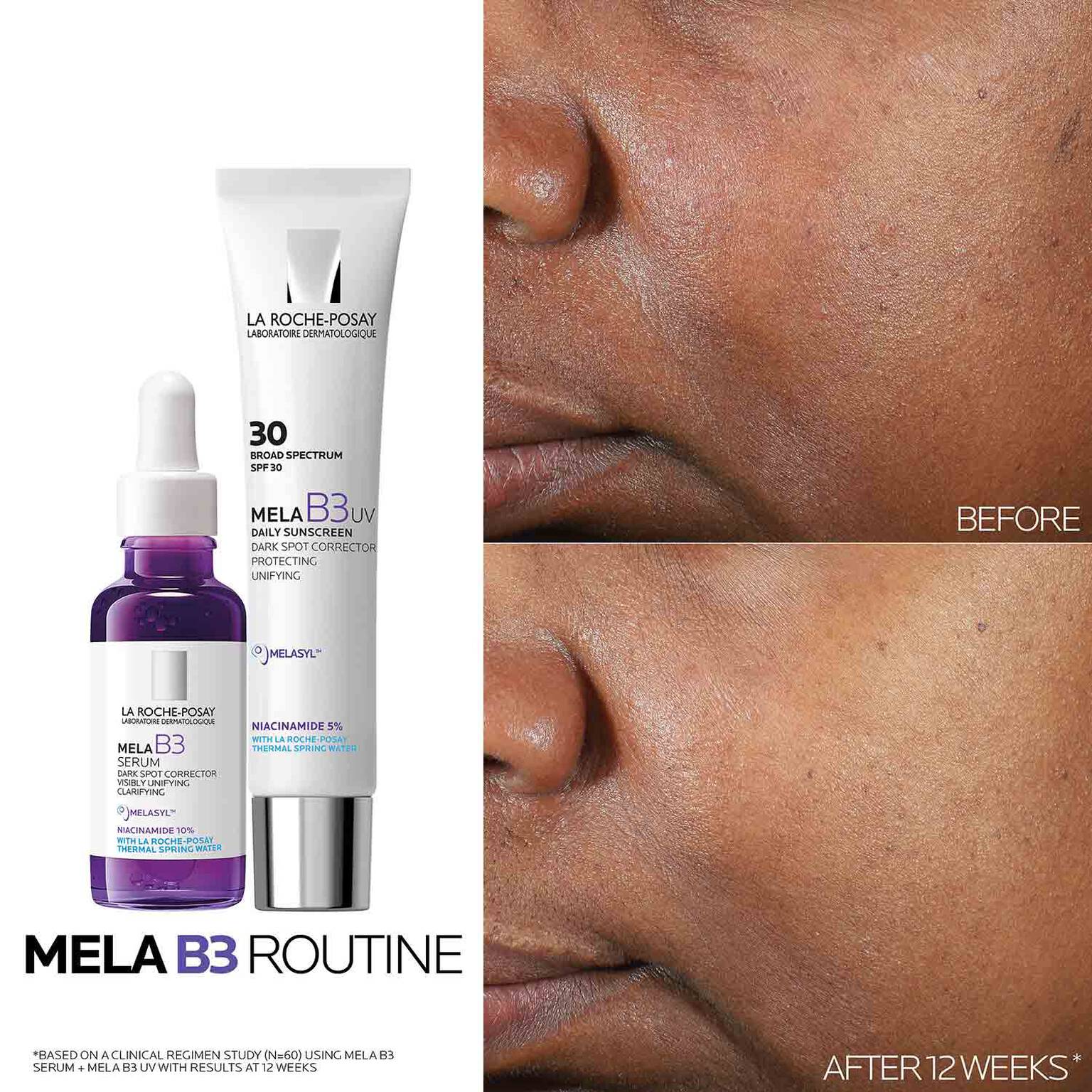 mela-b3-dark-spot-serum-with-melasyltm-niacinamide-s4 Mela-B3-routine_1500X1500.jpg